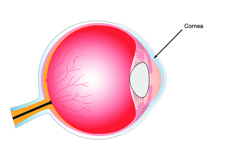 The cornea refracts light so it is directed to the retina at the back of the eyes chamber